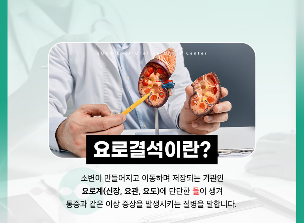 요로결석 설명 이미지